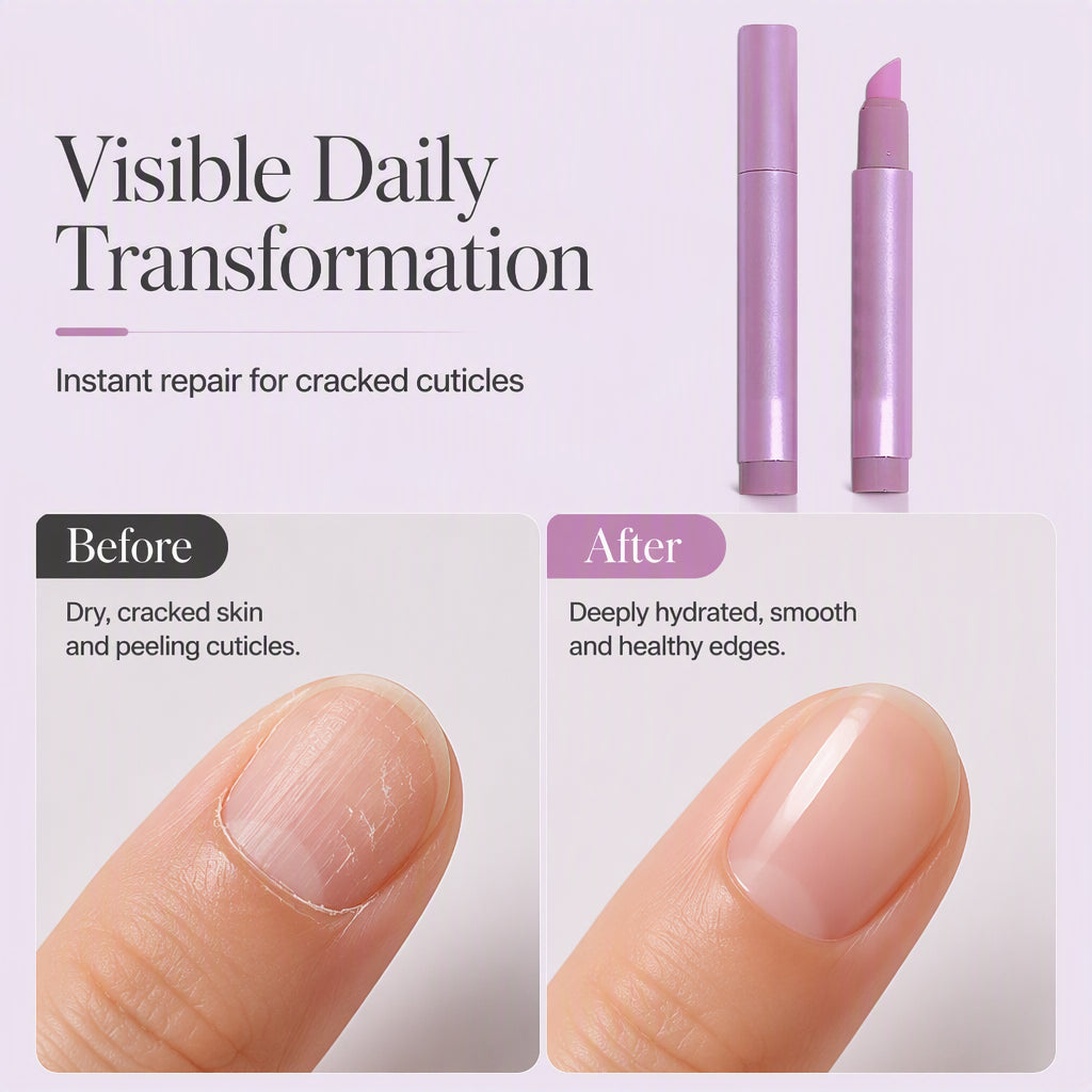 ✨BUY 1 GET 1 FREE! ✨Portable Nail Care Essence Pen
